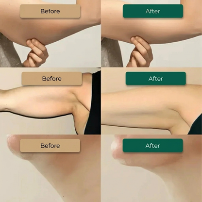 Lymphatic Drainage